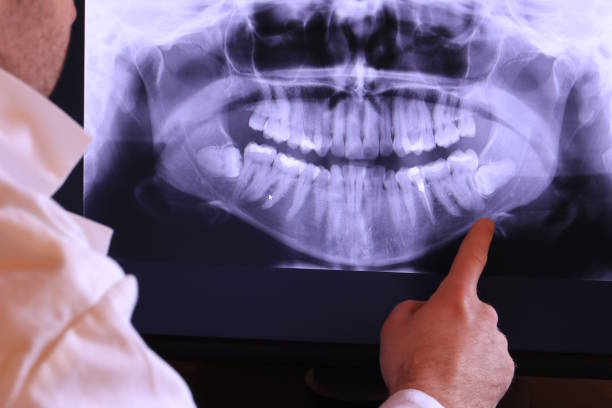 Best Emergency Treatment for Dental Infections or Abscesses in Milton, NY